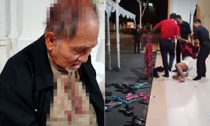 Bekas Adun cedera diserang lelaki kurang siuman depan masjid