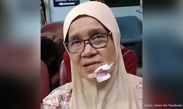 Endau rep injured in road accident