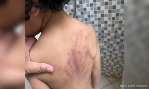 Tiada keterangan kukuh: Polis sahkan NFA kes dera budak autistik