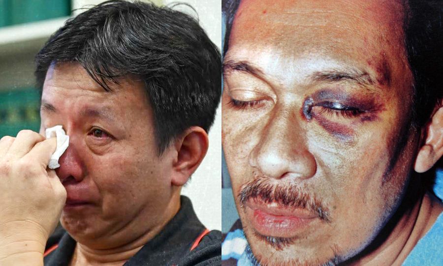 LFL bandingkan kes pemandu OKU dengan mata lebam Anwar