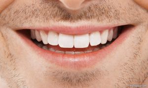 LETTER | Oral health, an overlooked aspect of HIV/AIDS
