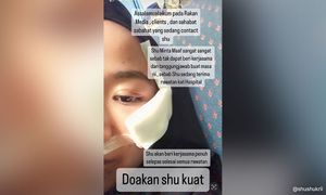 'Terima kasih untuk cacat kekal di muka aku'