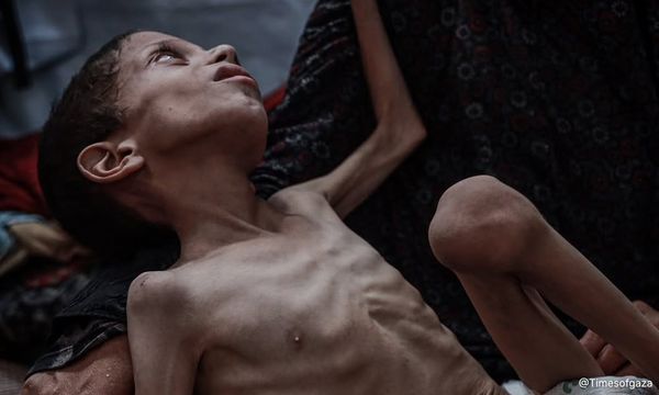 UN: More than 54,600 children suffering from acute malnutrition in Gaza