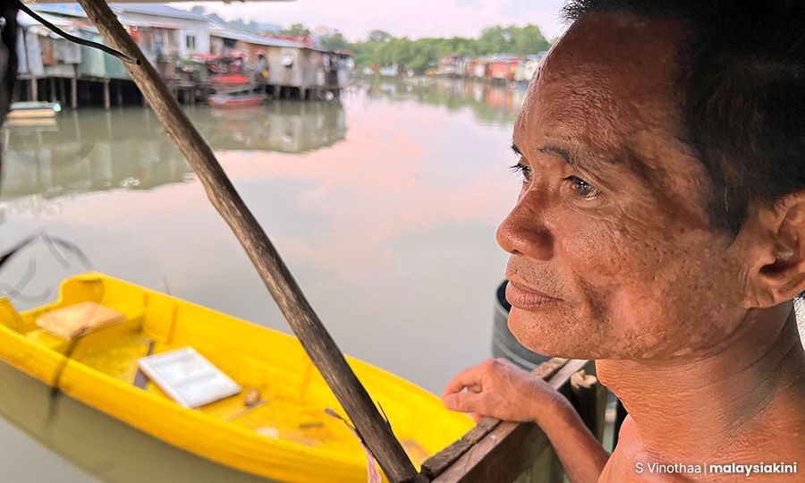 Toddler’s death by croc shows tragedy of statelessness