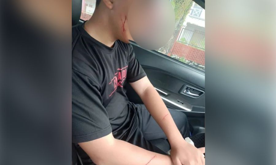 Remaja lelaki berjaya selamatkan diri daripada diculik