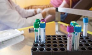 COMMENT | Is premarital HIV testing doing the right thing?