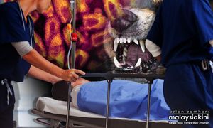 砂再通报一宗狂犬病死亡病例，今年第5宗