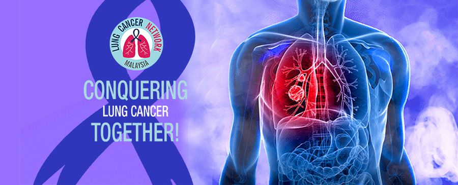 First AI-detected lung cancer case in Malaysia marks a breakthrough in early detection