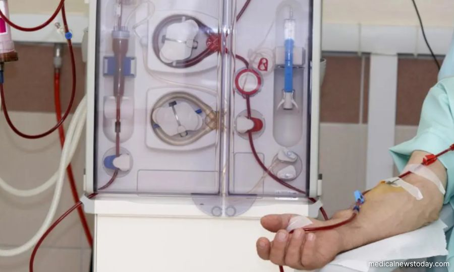 Nearly 9.5k new kidney patients require dialysis each year - Lukanisman