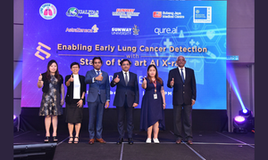 Healthcare Partners Collaborate To Broaden Access To Lung Cancer Diagnosis With Artificial Intelligence Technology